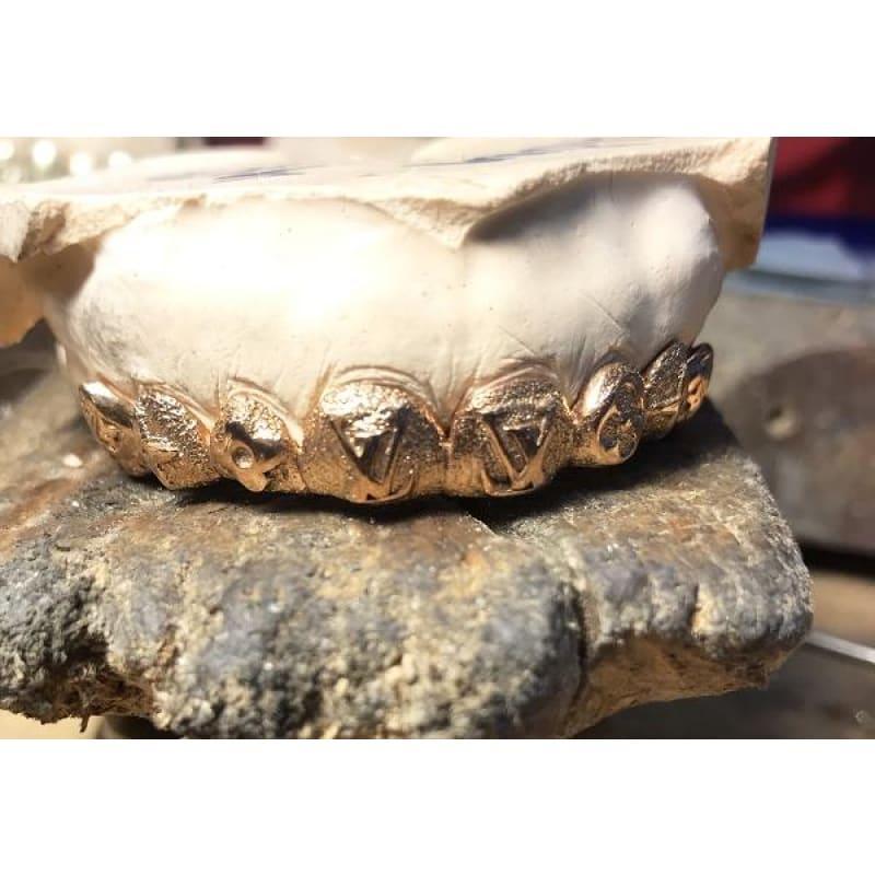 8pc Rose Gold Lasered Grillz - Seattle Gold Grillz