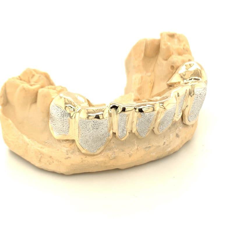 8pc Two Tone Diamond Dust Bottom Grillz - Seattle Gold Grillz