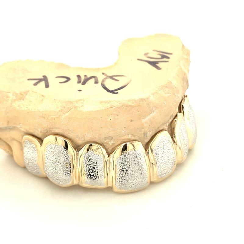 8pc Two Tone Dust Top Grillz - Seattle Gold Grillz