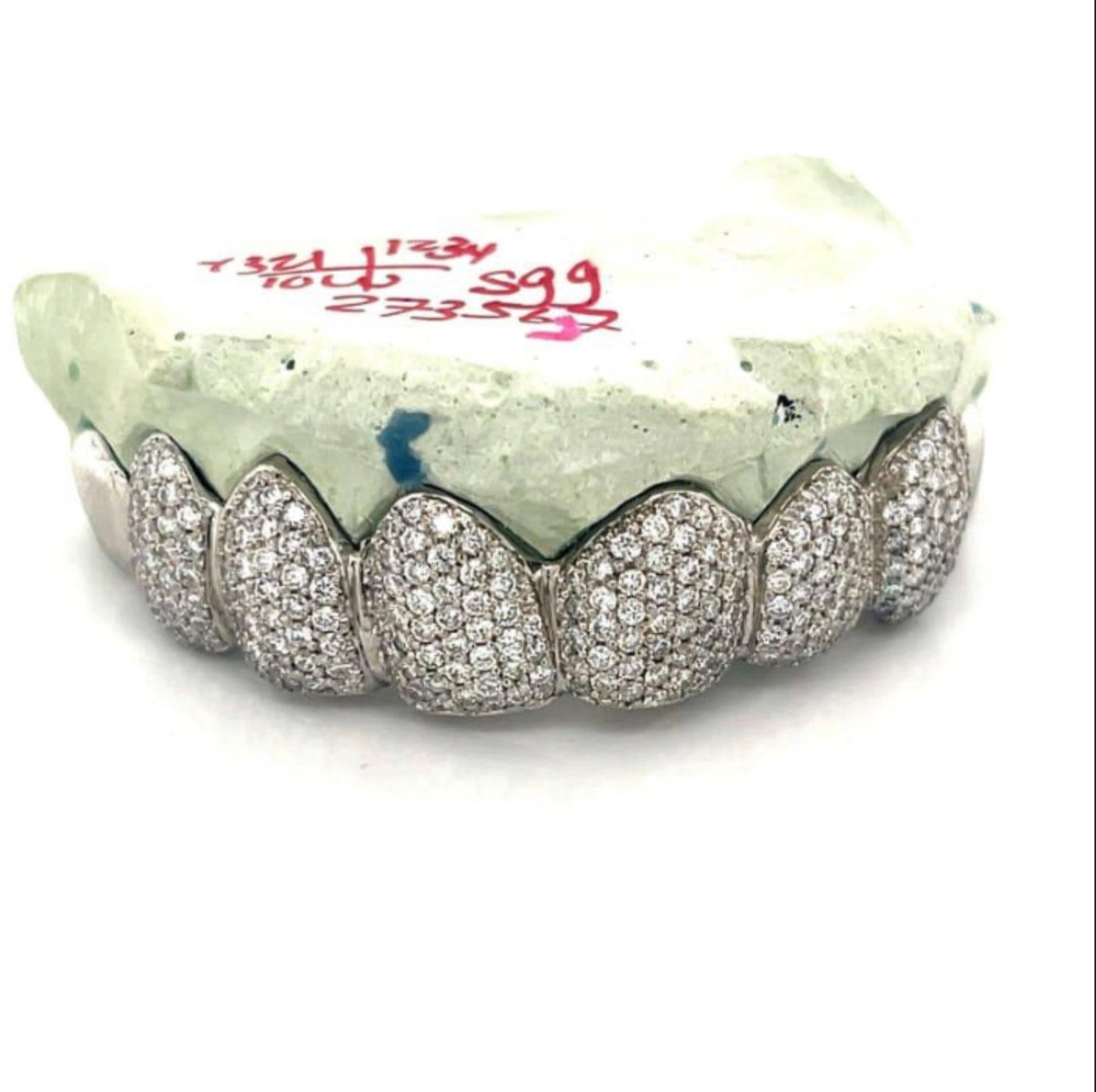 8pc White Gold Diamond Top Grillz - Seattle Gold Grillz