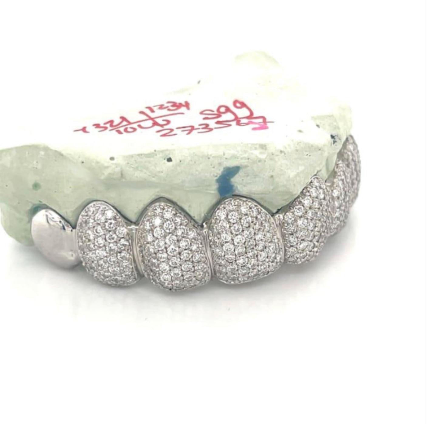 8pc White Gold Diamond Top Grillz - Seattle Gold Grillz