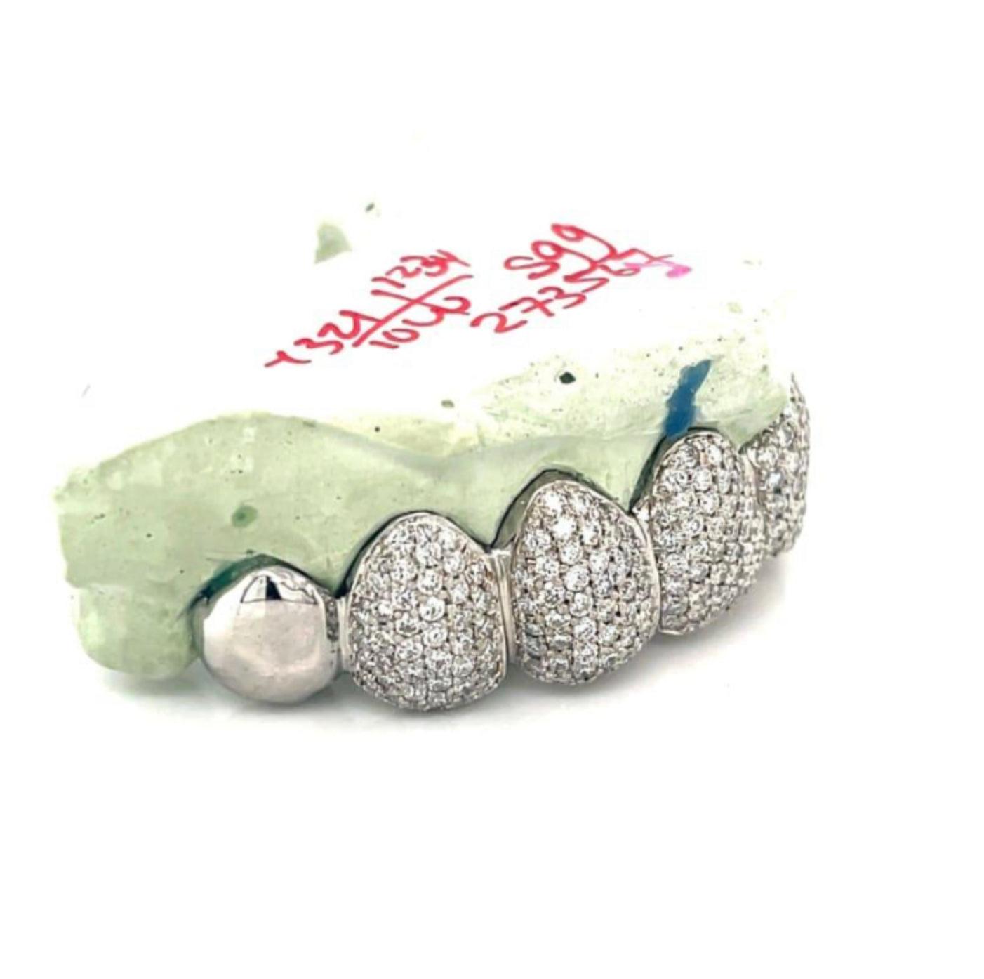 8pc White Gold Diamond Top Grillz - Seattle Gold Grillz