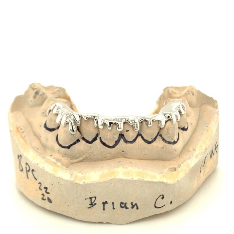 8pc White Gold Drip Bottom Grillz - Seattle Gold Grillz