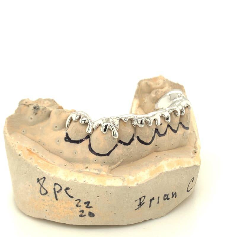8pc White Gold Drip Bottom Grillz - Seattle Gold Grillz