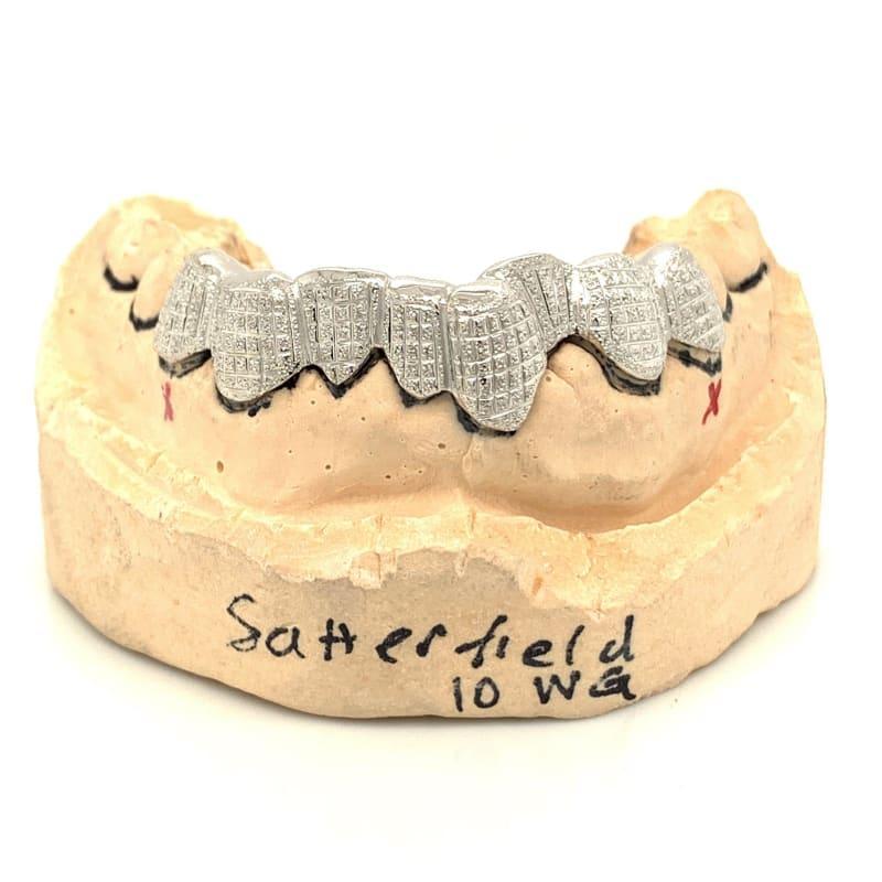8pc White Gold Dusted Bricks Grillz - Seattle Gold Grillz