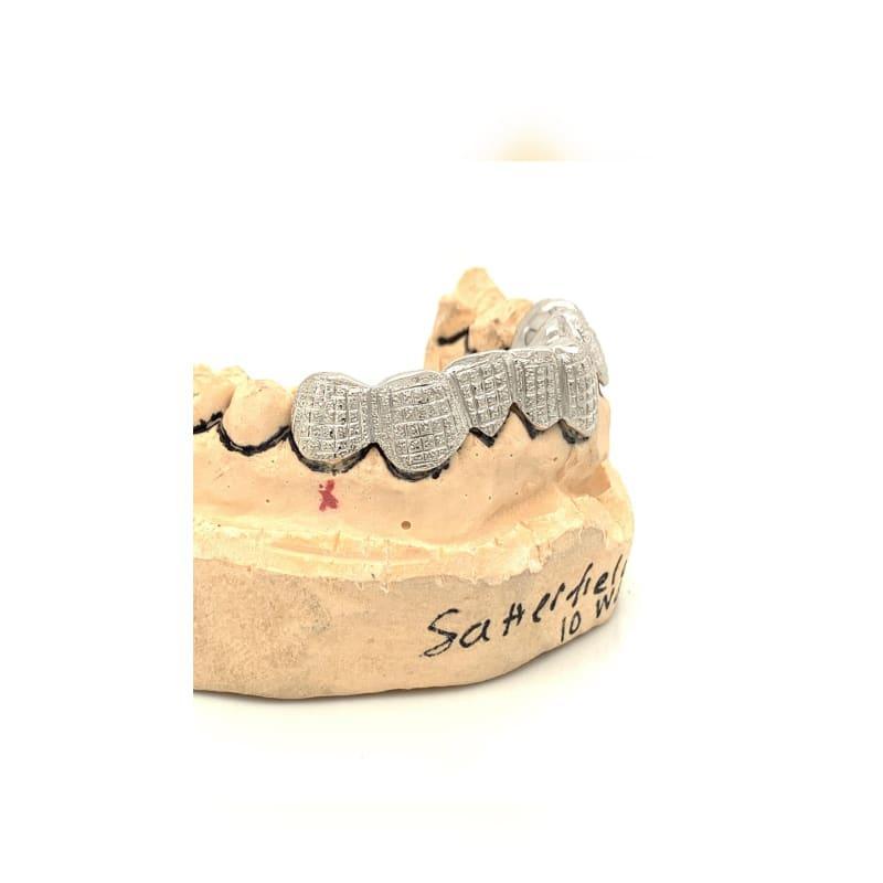 8pc White Gold Dusted Bricks Grillz - Seattle Gold Grillz