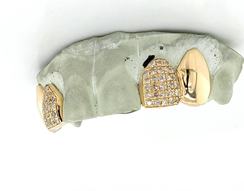 4pc Gold Diamond Incisor Grillz