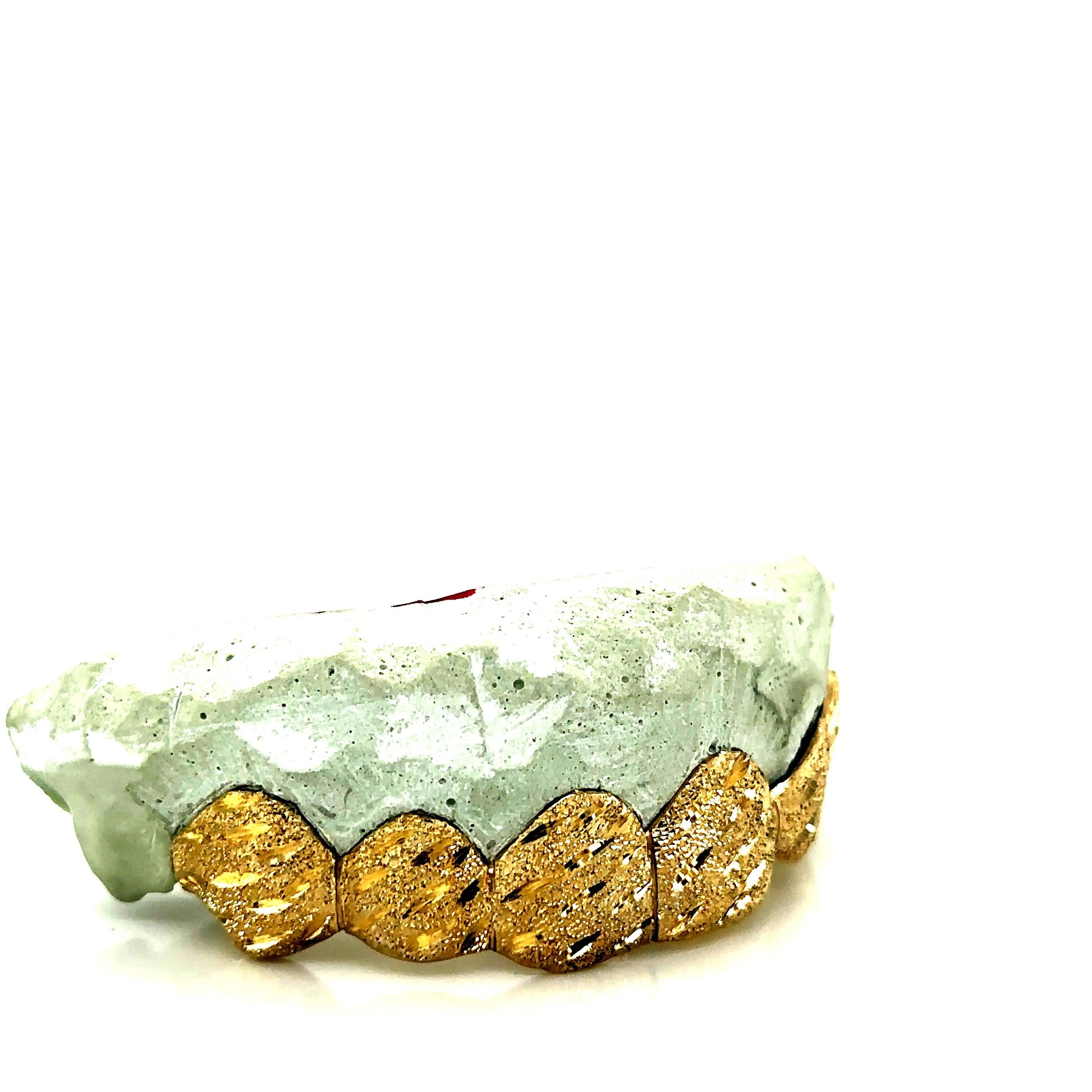 6pc Gold Raindrop Top Grillz