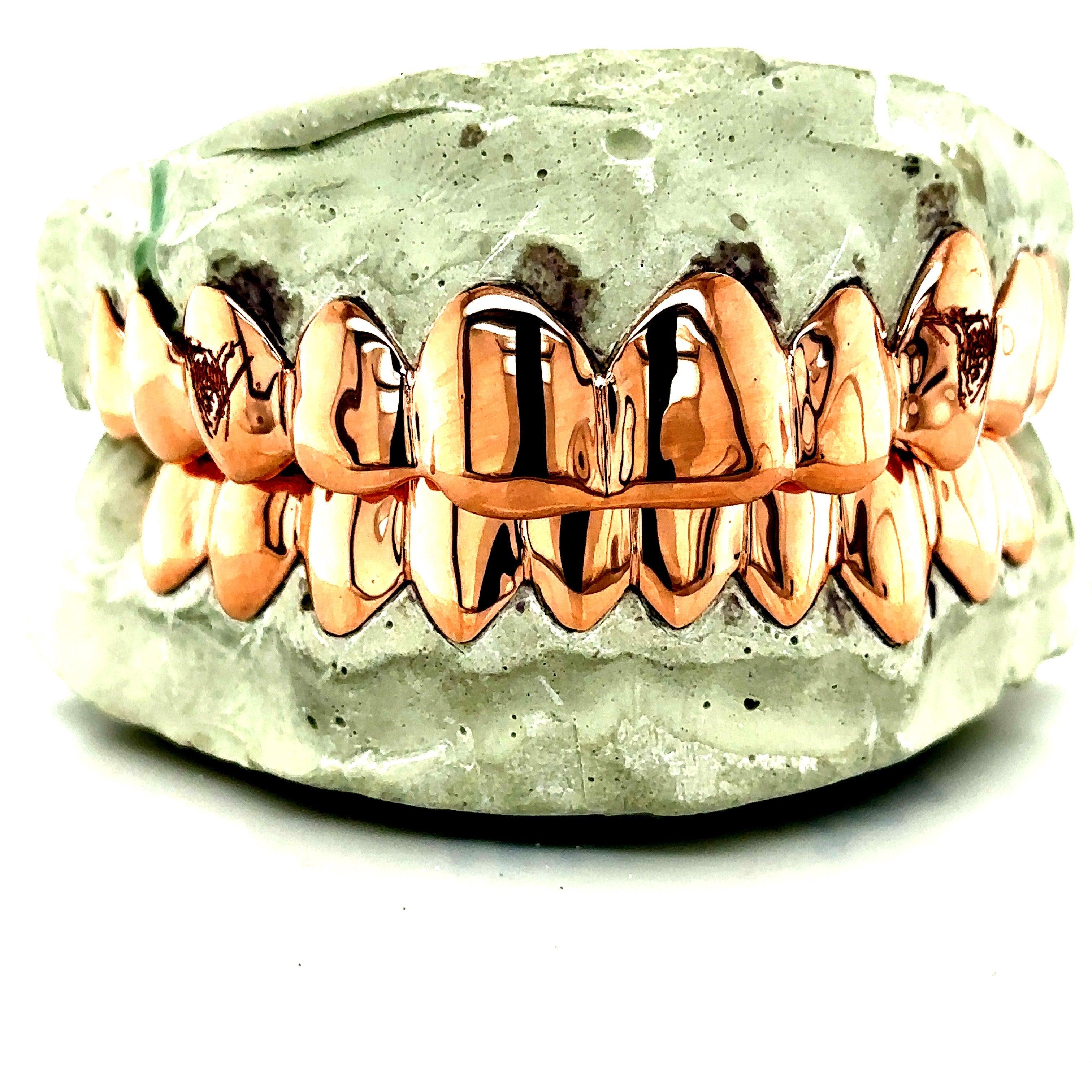 20pc Rose Gold Engraved Grillz
