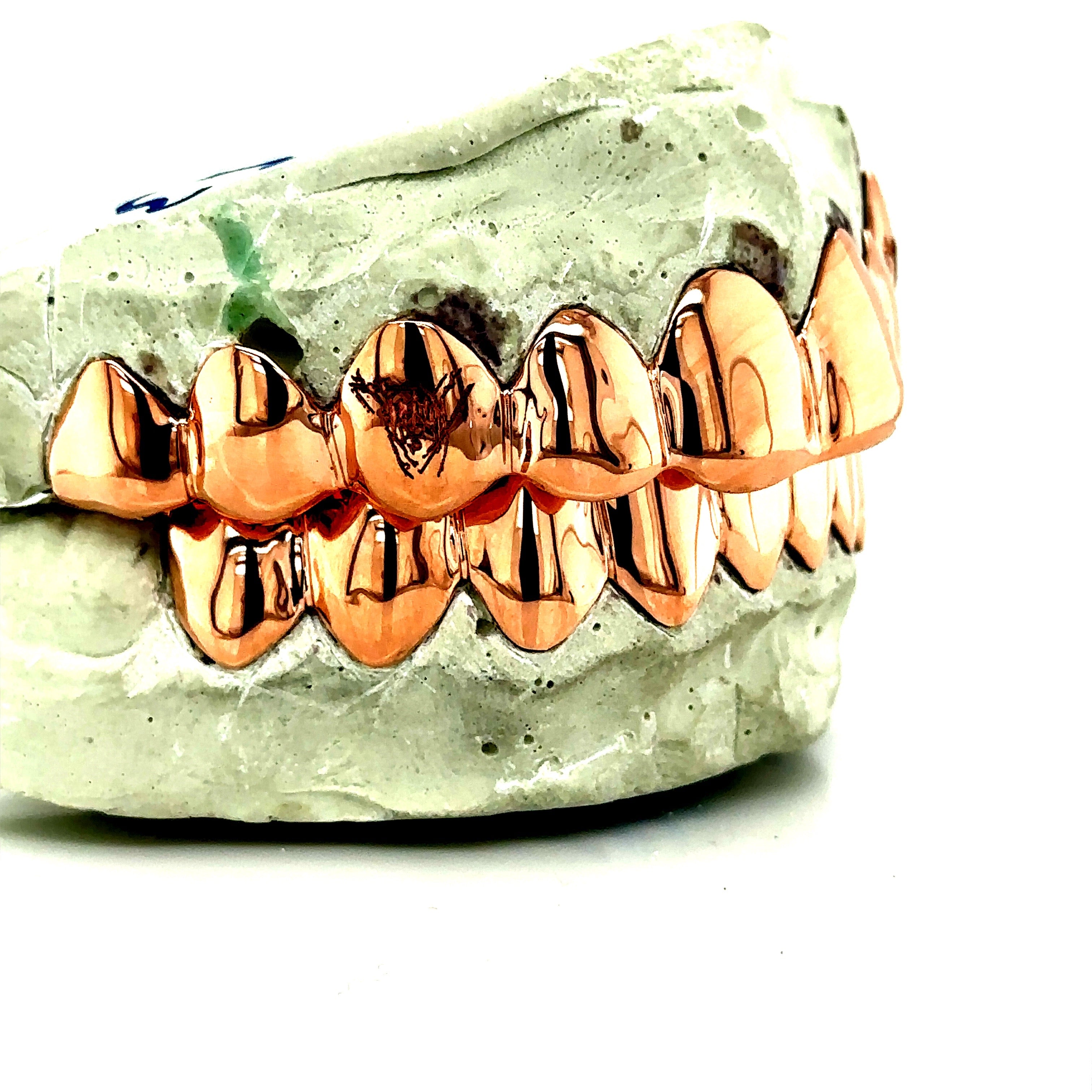 20pc Rose Gold Engraved Fang Grillz