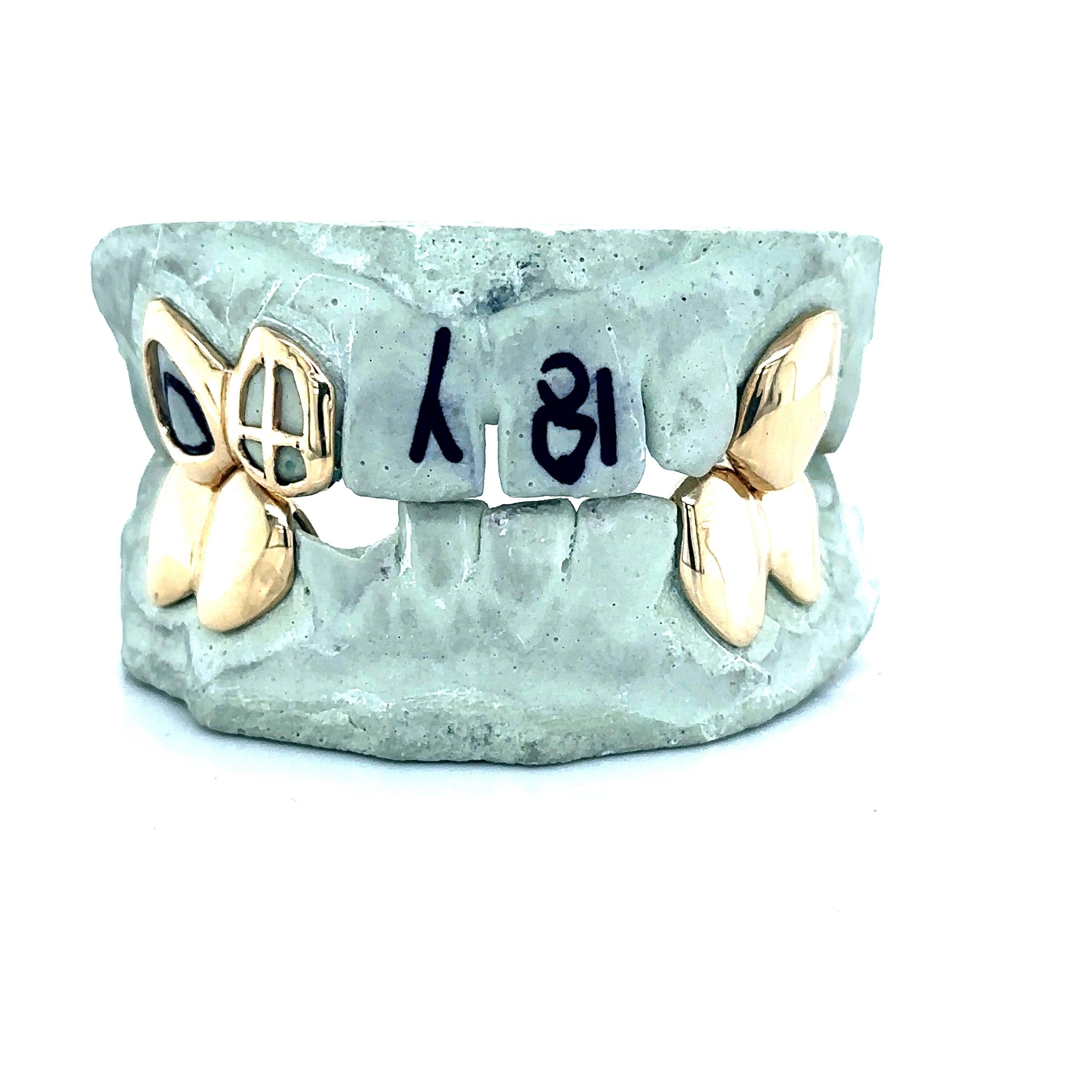 7pc Gold Open Face Grillz