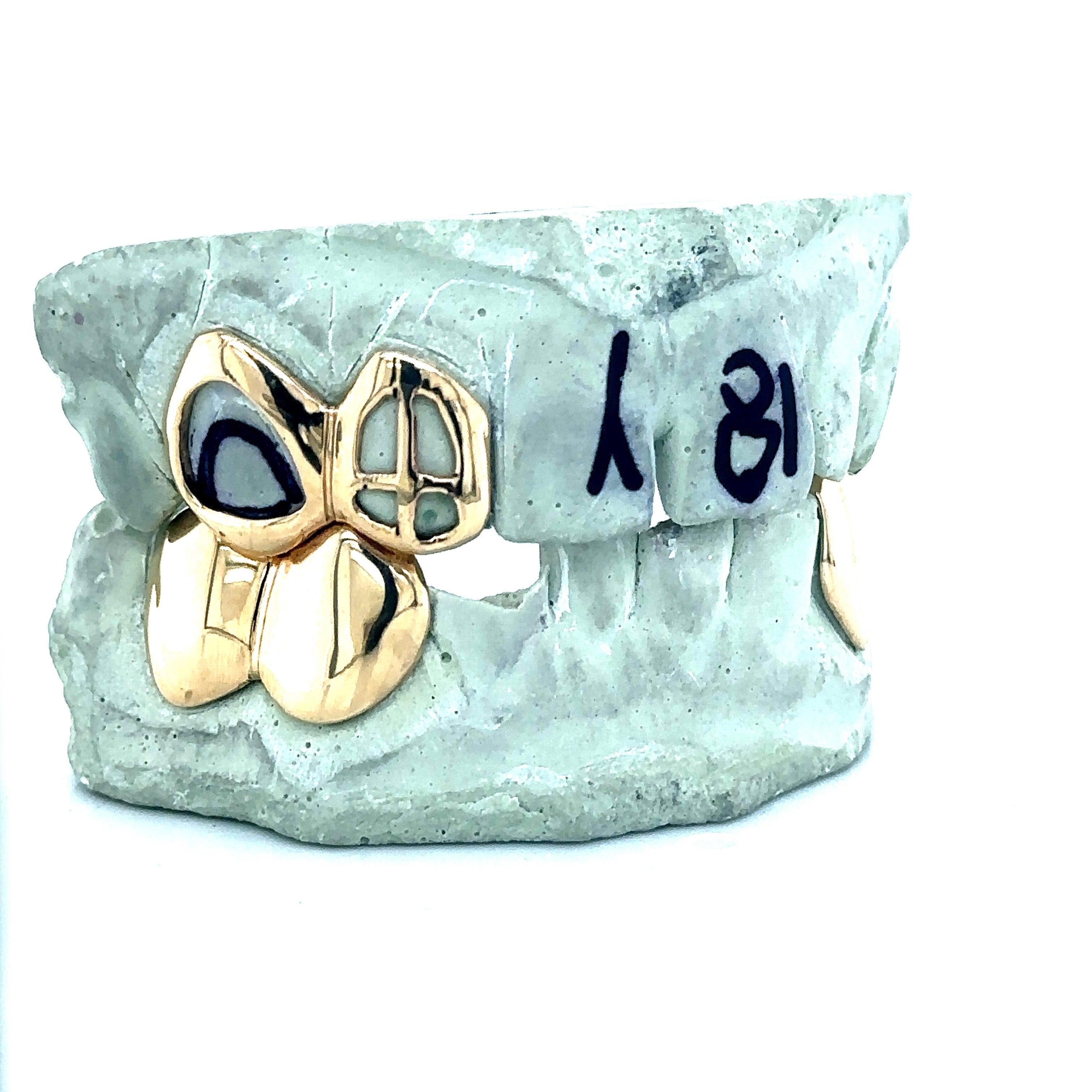 7pc Gold Open Face Grillz