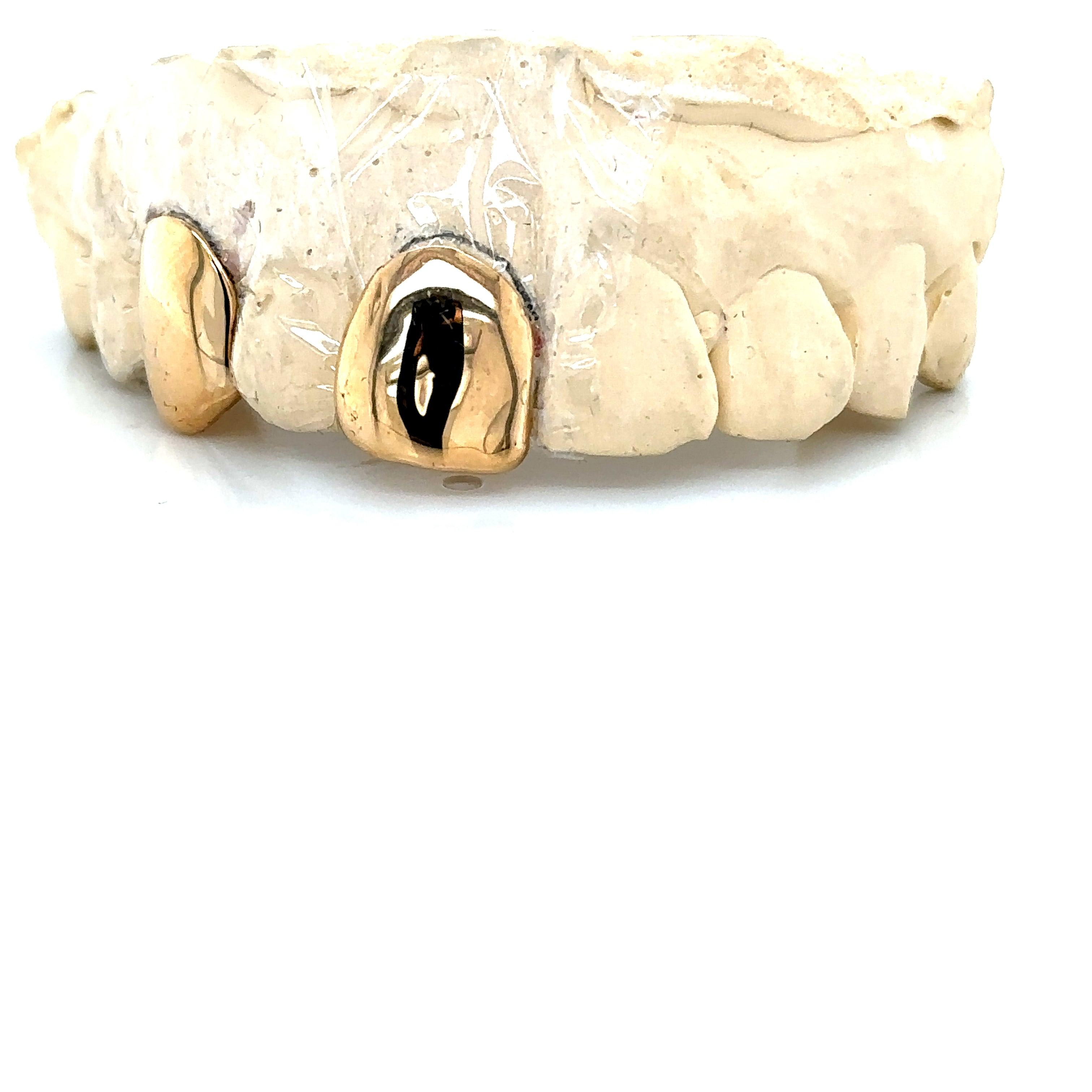 2pc Gold Front Tooth Fang Top Grillz