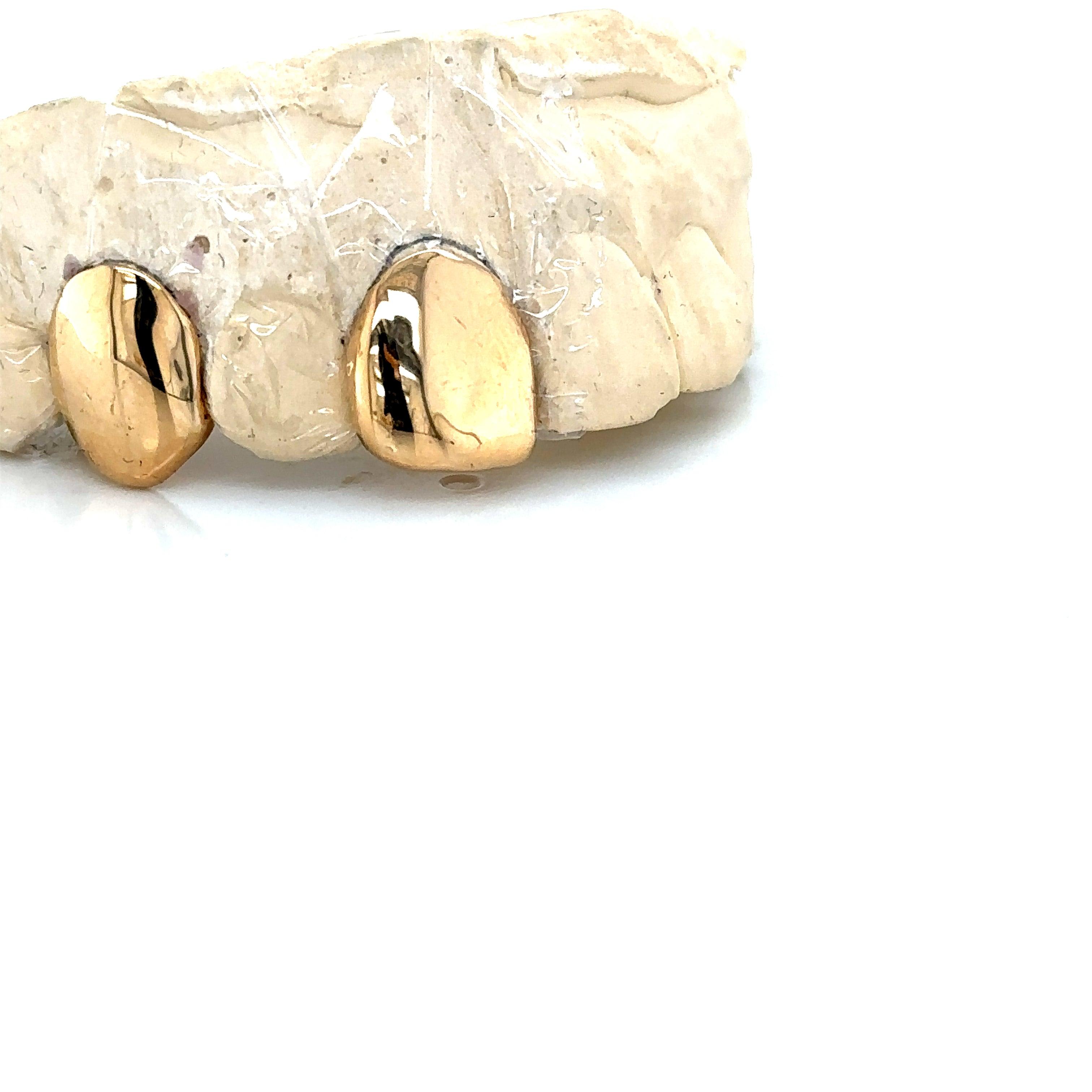 2pc Gold Front Tooth Fang Top Grillz