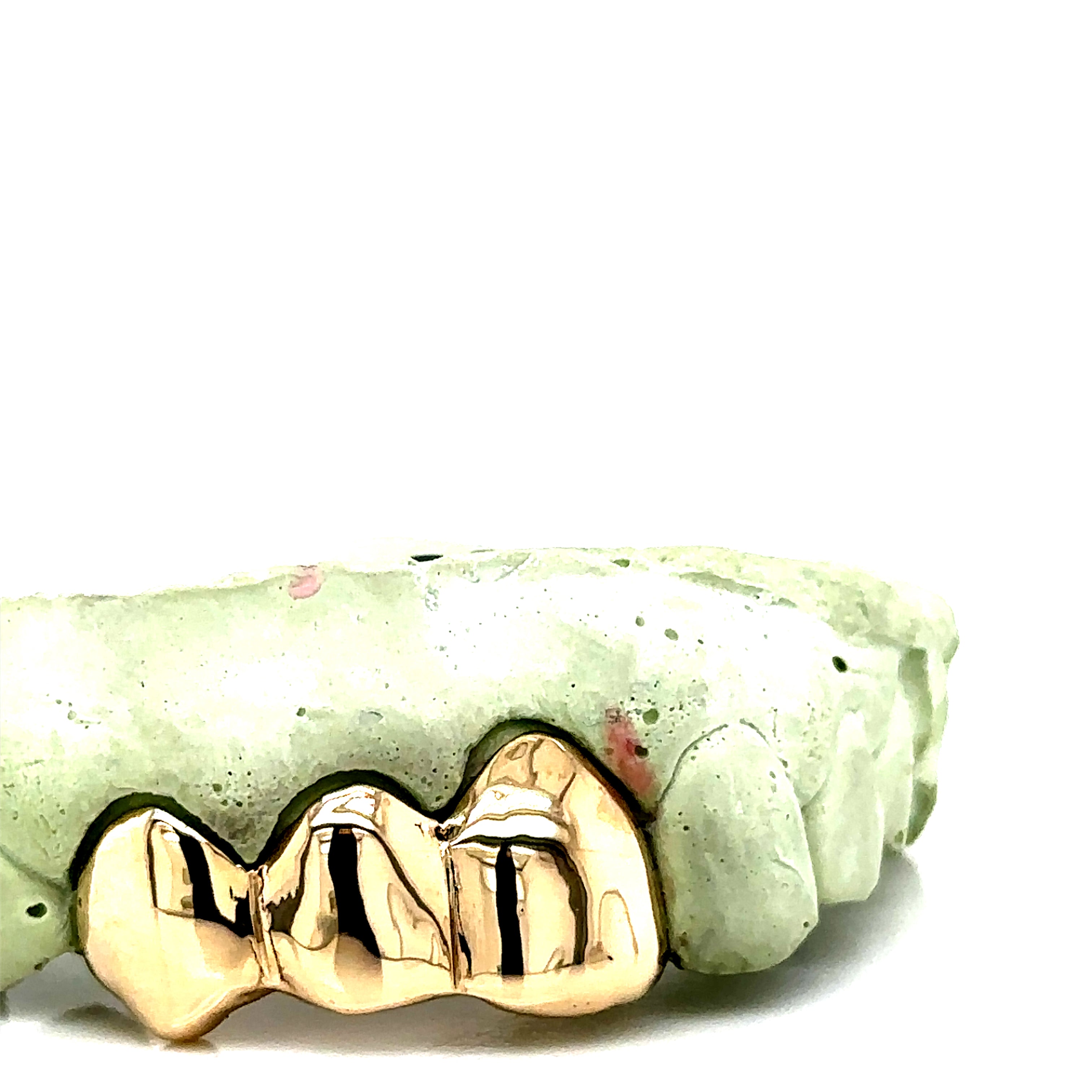 3pc Gold Top Grillz