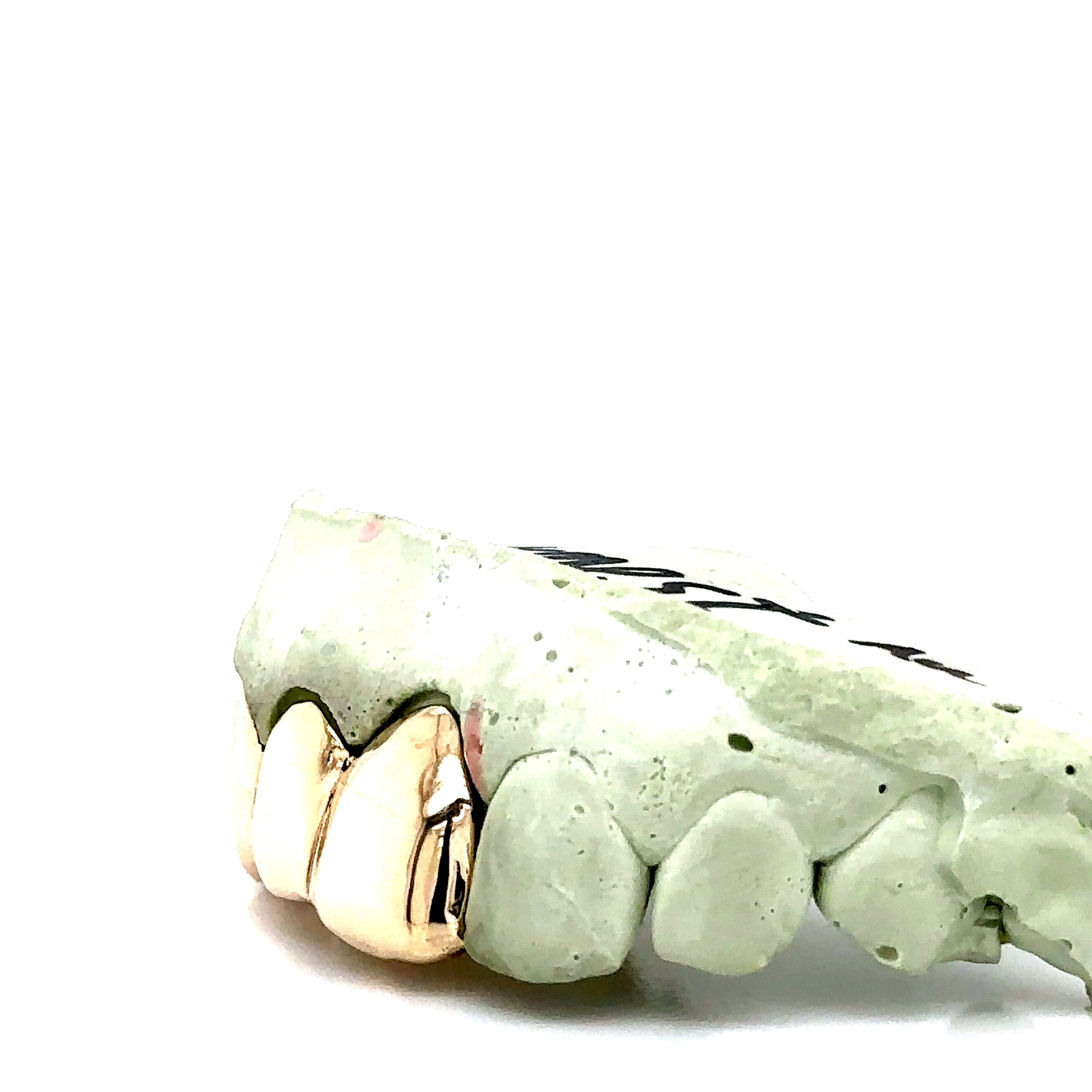 3pc Gold Top Grillz