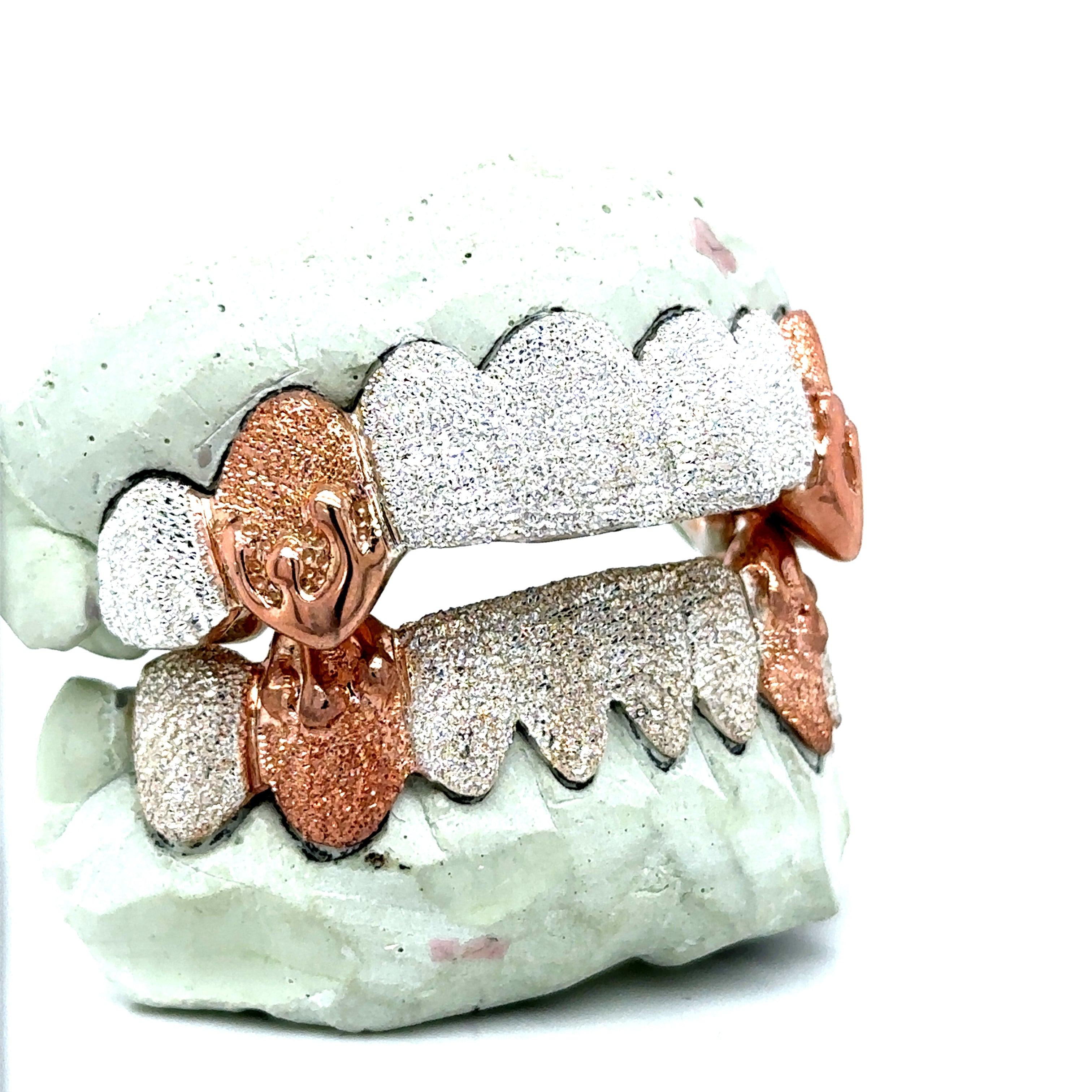 16pc Silver Dusted Rose Gold Drip Grillz