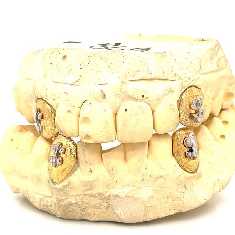 Gold Diamond Dust Dollar Sign Fangs - Seattle Gold Grillz