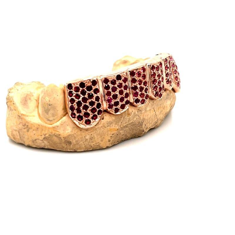 Rose Gold Color of Red Grillz - Seattle Gold Grillz
