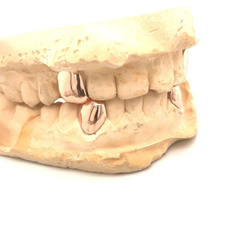 Rose Gold Fang Grillz Set - Seattle Gold Grillz