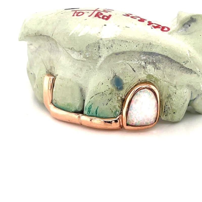 Rose Gold Gap Opal Grillz - Seattle Gold Grillz