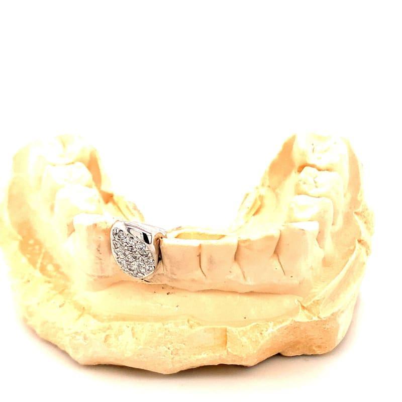 Single Diamond Bottom Fang Grillz - Seattle Gold Grillz