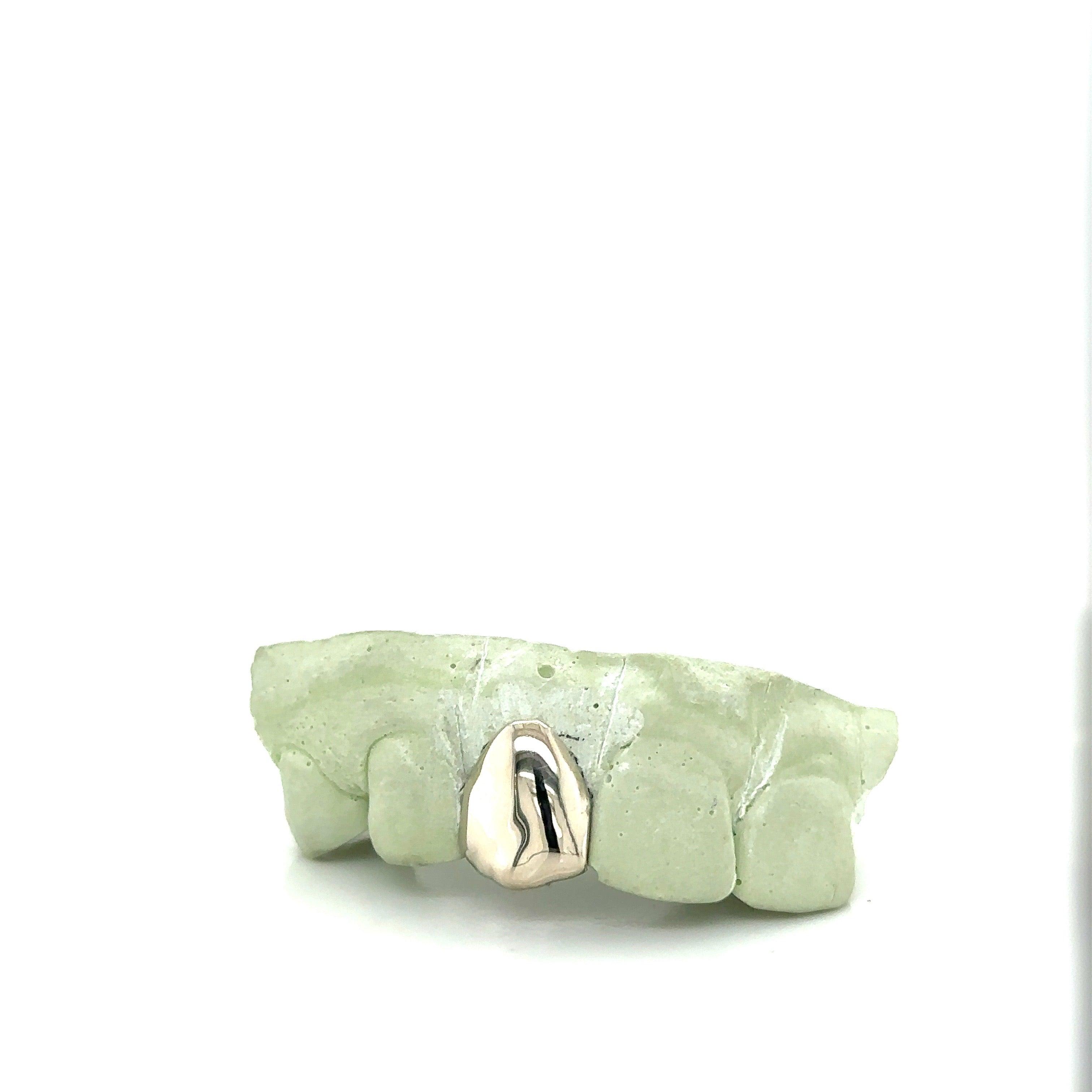 White Gold Right Side Incisor Tooth - Seattle Gold Grillz