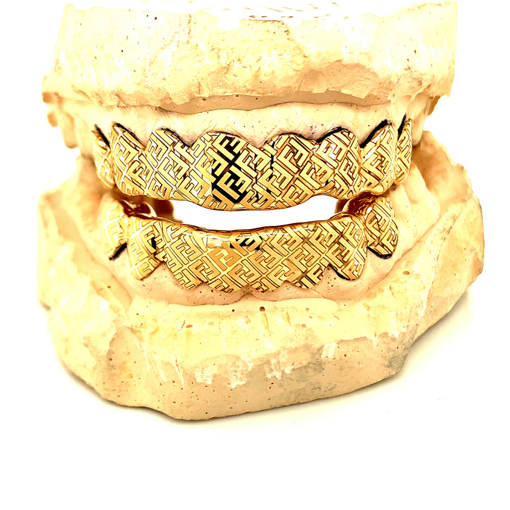 Diamond Cut Grillz by Seattle Gold Grills